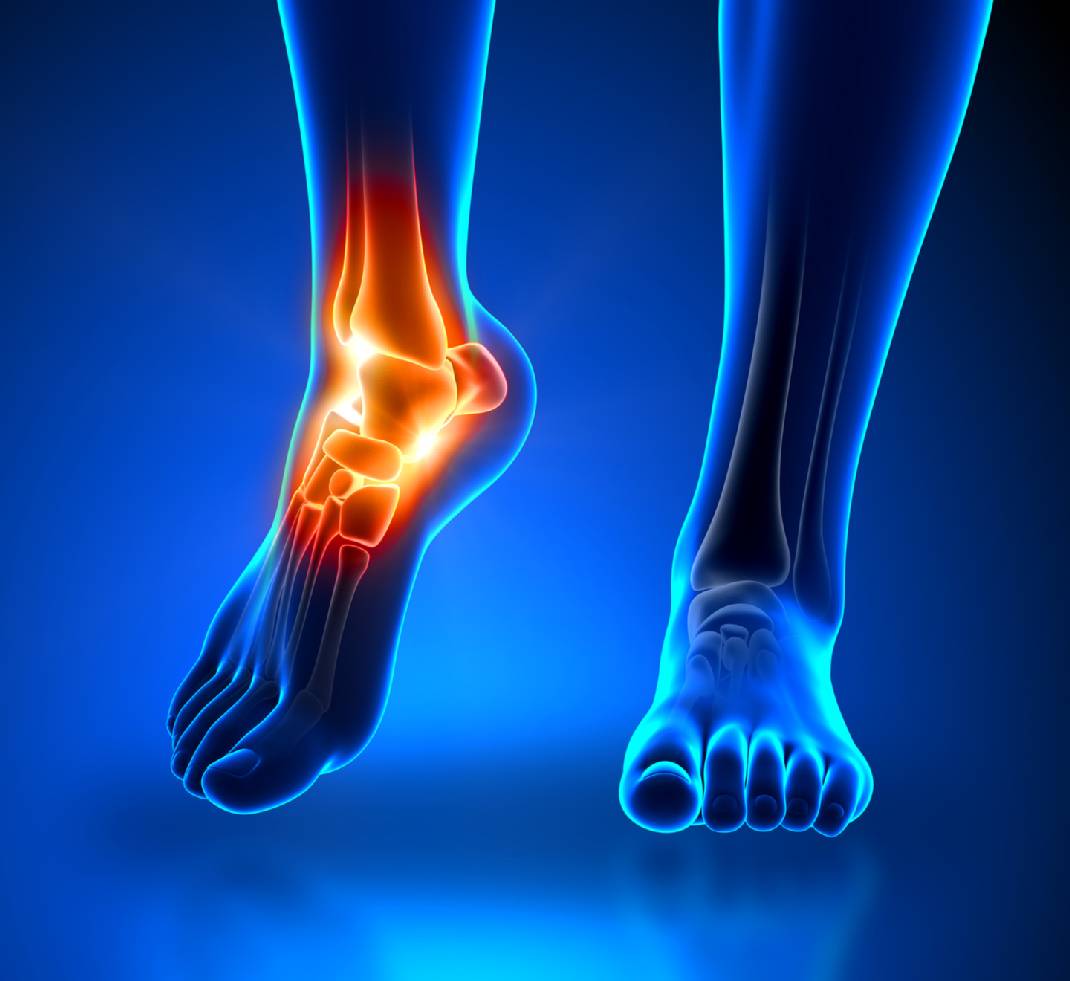 Erkrankungen der Füße, Fußschmerzen