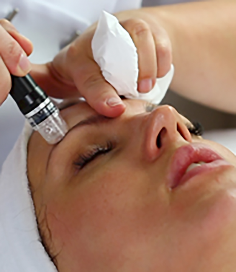 Kosmetikstudio Beauty Mosaic - Aquabration Gesichtsbehandlung mit Sauerstoff