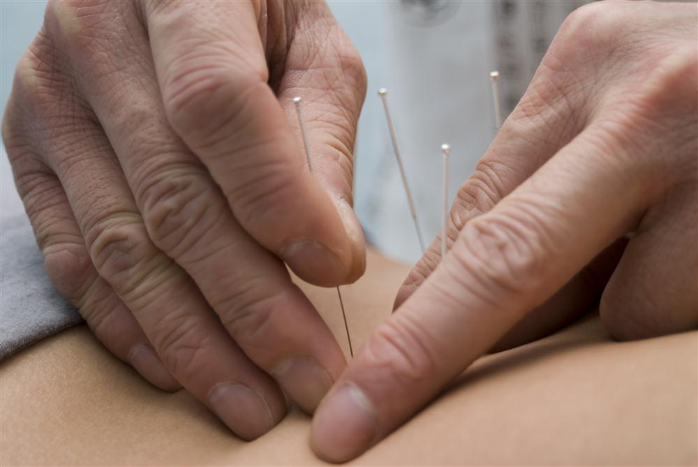 In Ihrer Hausarztpraxis in Pulheim wird auch Akupunktur angeboten. Fragen Sie uns nach den vielfältigen Möglichkeiten dieser Behandlungsmethode.