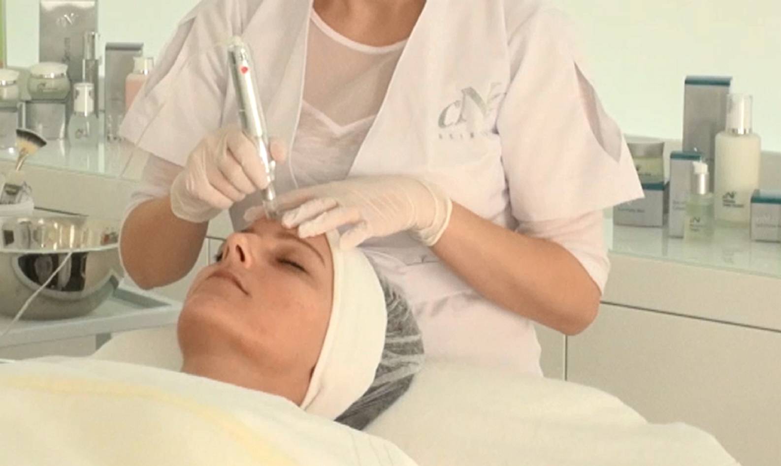 Mikro-Needling ist ein effektives Verfahren im Bereich des Anti-Aging - Ihre Kosmetikexperten in Wildberg