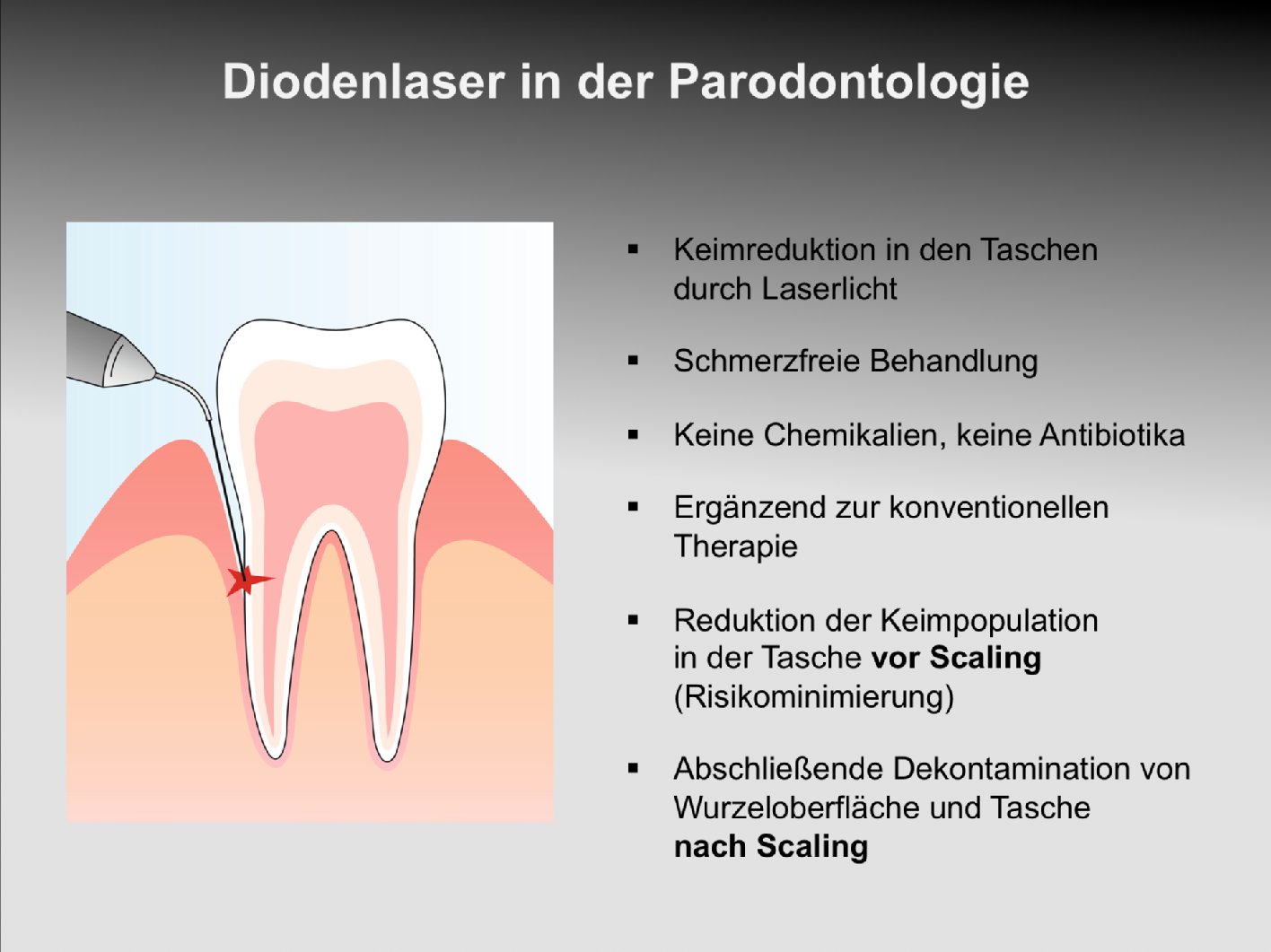 Erfahren Sie in unserer Praxis in Oberhausen-Rheinhausen mehr über den Einsatz eines Lasers in der Parodontologie.