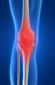 Dr. Weber und Dr. Engel behandeln in ausgewählten Fällen von Kniegelenksarthrose mit Hyaluronsäureeinspritzungen.