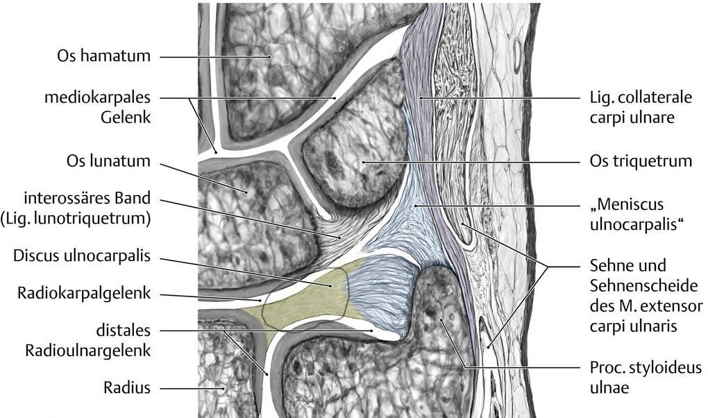 Heidemann Hand Und Ellenbogenchirurgie In Hurth Diskus Triangularis Tfcc Verletzungen Und Erkrankungen